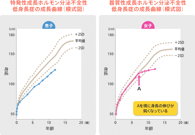 特発性成長ホルモン分泌不全性低身長症の成長曲線（模式図）　器質性成長ホルモン分泌不全性低身長症の成長曲線（模式図）